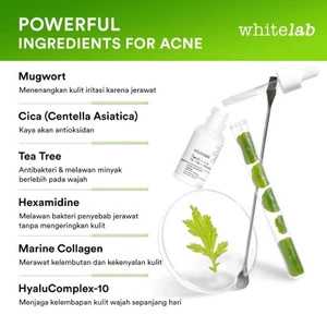 Acne Calming Serum (new Formula)